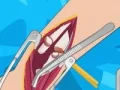 Arm surgery 2