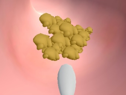 ਈਅਰਵੈਕਸ ਕਲੀਨਿਕ 